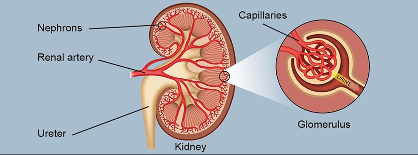 education-hope-kidney-clinic
